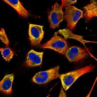 免疫荧光(冰冻/石蜡-单标)