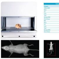 全身骨密度检测