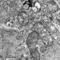 透射电镜实验服务