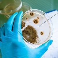 微生物多样性分析_微生物多样性测序_高通量测序分析微生物多样性