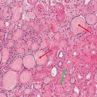 肾小管间质纤维化动物模型 泌尿系统模型