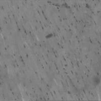 阿霉素诱导大鼠心肌病模型