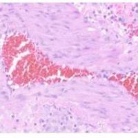 肺动脉高压动物模型动物实验