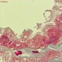 缺血性急性肾衰竭动物模型 泌尿系统模型