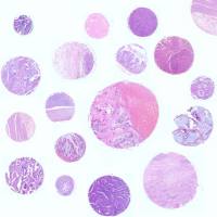 正常脏器预后组织芯片