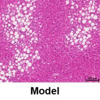 非酒精性脂肪肝模型