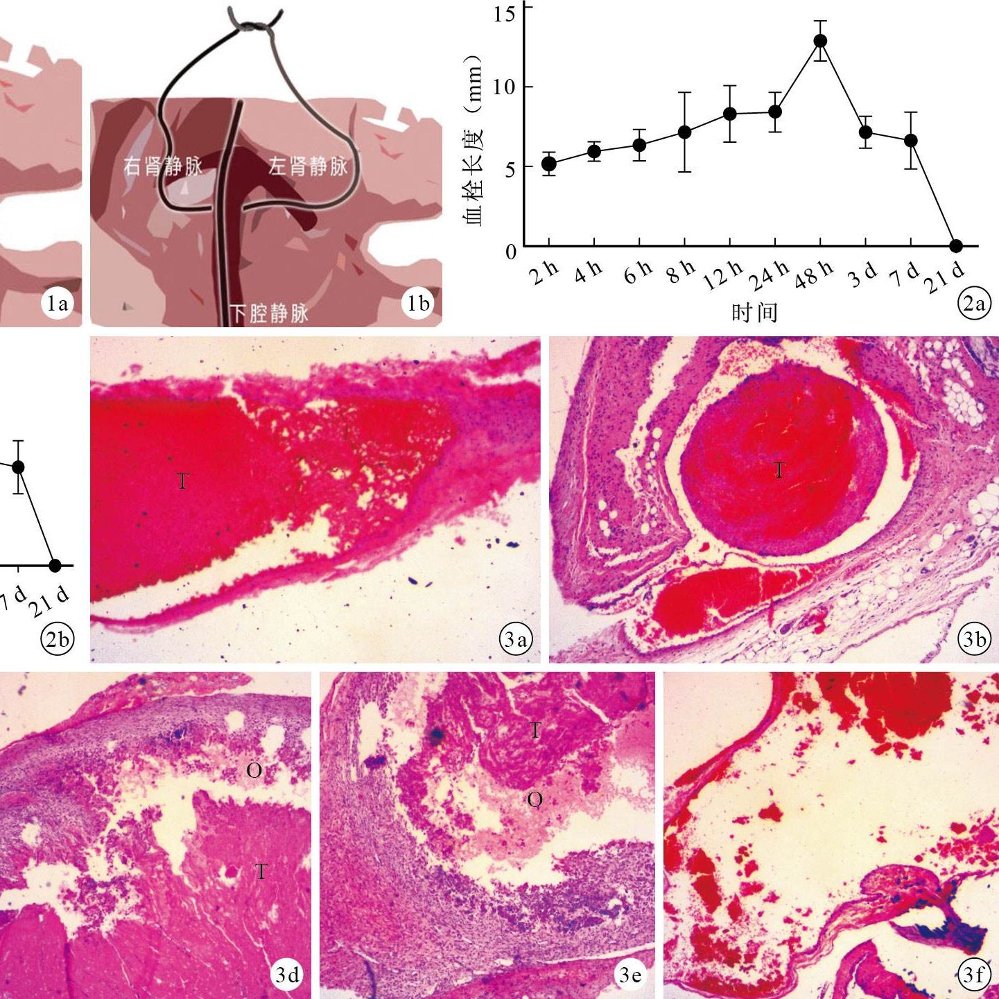 体内血栓动物模型
