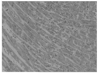 阿霉素诱导大鼠心肌病模型