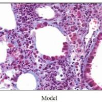 肺纤维化模型  呼吸系统模型