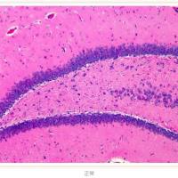 脑缺血及再灌注模型动物实验