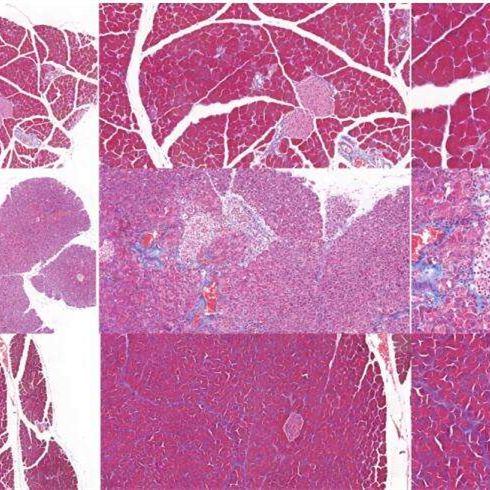 胰腺炎动物模型  消化系统模型