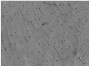 阿霉素诱导大鼠心肌病模型