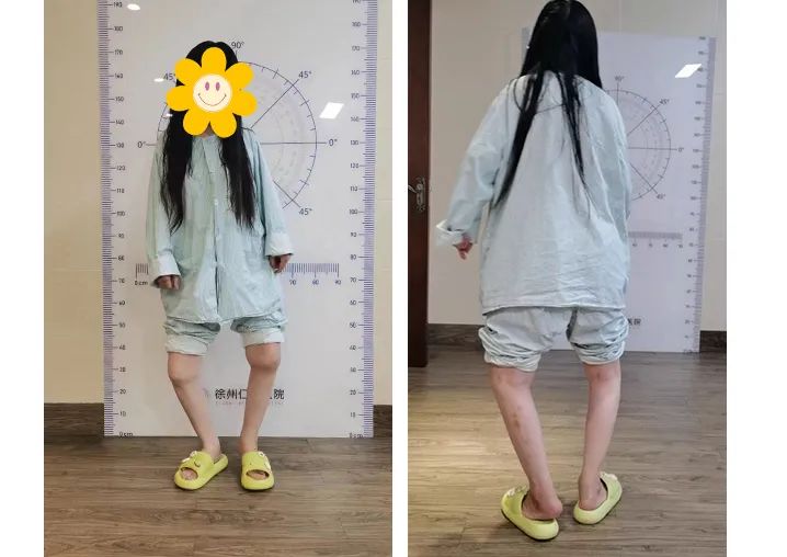 当关节置换机器人对上「不死的癌症」,这场关于类风湿性关节炎的战役究竟谁能胜出?