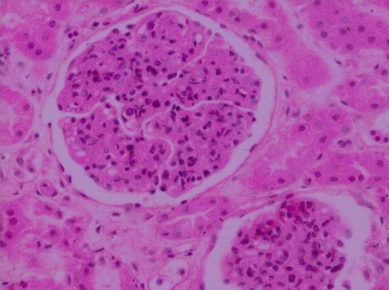 肾盂肾炎动物模型  泌尿系统模型