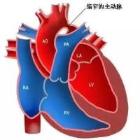 主动脉弓缩窄模型