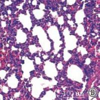 急性肺损伤模型  呼吸系统模型