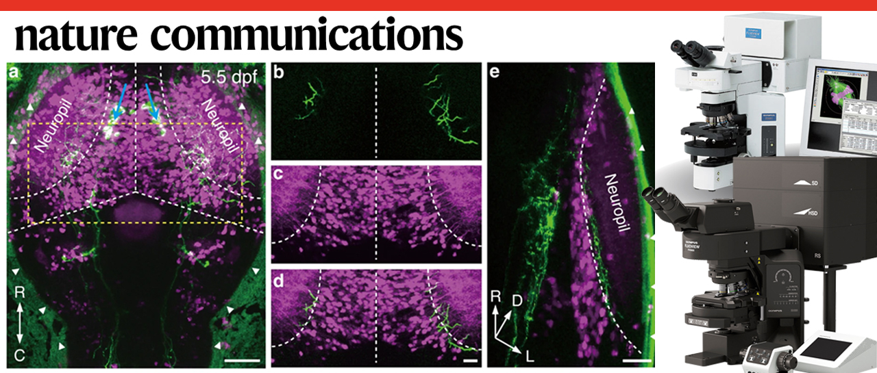 科技前沿 | 中科院脑智卓越中心杜久林团队揭示突触发育的昼夜节律性