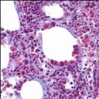 肺纤维化模型 呼吸系统模型