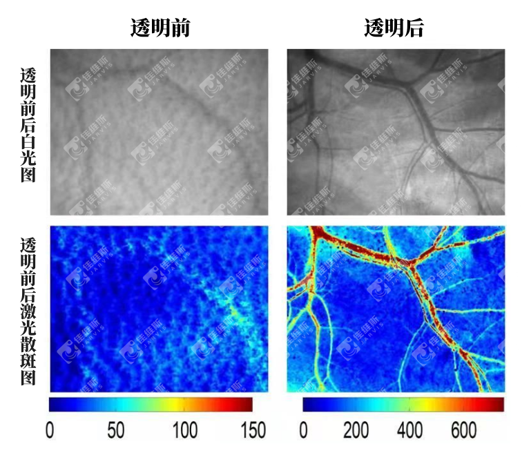 活体皮肤透明前后激光散斑成像