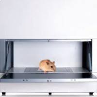 全身骨密度检测