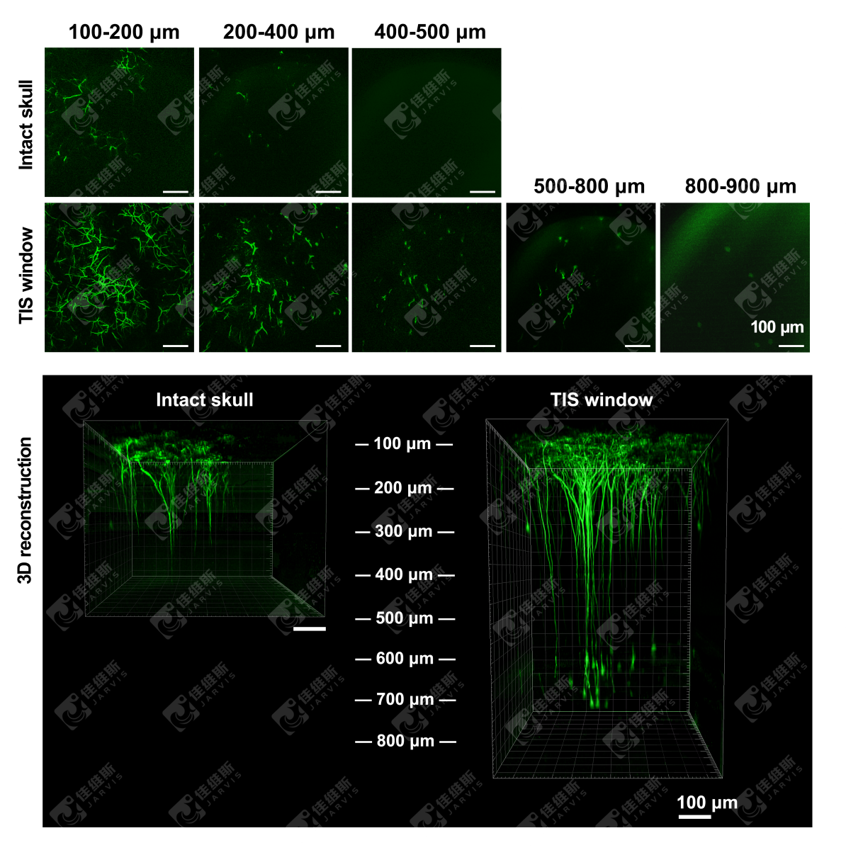 活体颅骨光透明前后大脑皮层神经双光子成像