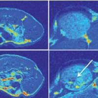 裸鼠腹水瘤模型