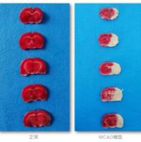 脑缺血及再灌注模型动物实验