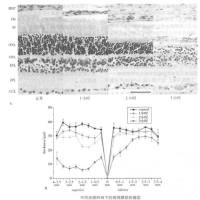 视网膜损伤模型 五官系统模型
