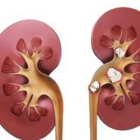 肾结石动物模型  泌尿系统模型