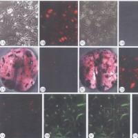 裸鼠肺转移瘤药效评估
