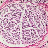 坐骨神经，面神经损伤动物模型 神经系统模型