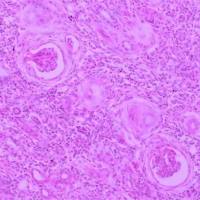 肾盂肾炎动物模型  泌尿系统模型