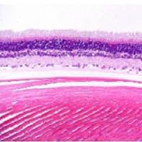 视网膜黄斑变性模型