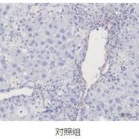 脓毒症模型  消化系统模型