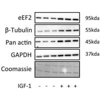 WB（蛋白质免疫印迹）