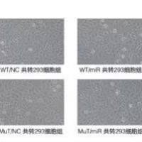 双荧光素酶检测