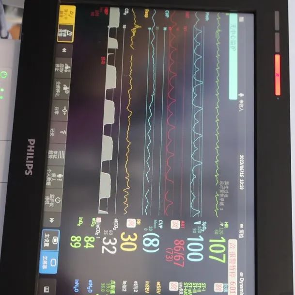 迎难而上！西安高新医院再完成一例人工心脏植入手术