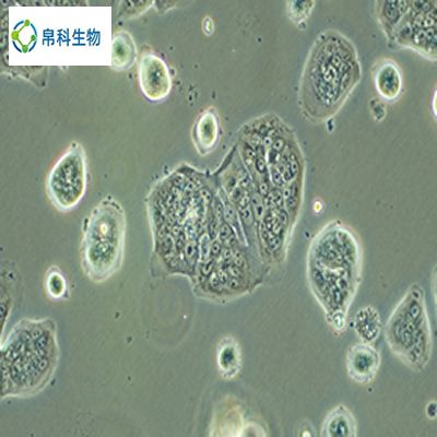 HFSF（人胚胎眼巩膜成纤维细胞）