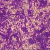 Transwell检测细胞侵袭