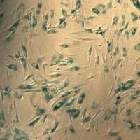 β-半乳糖苷酶染色