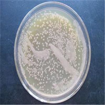 硝酸盐阴性不动杆菌