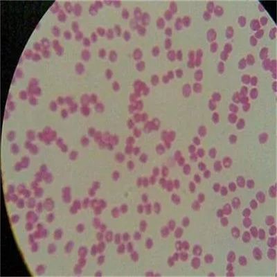荧光假单胞菌生物型F