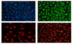 溶酶体免疫荧光法
