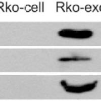 WB验证外泌体靶蛋白