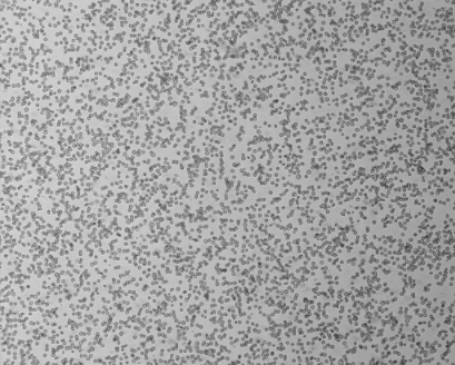 细胞攻略 | THP-1(人单核细胞白血病细胞)细胞培养教程