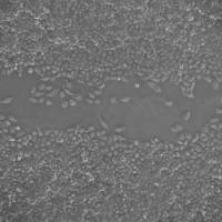 Transwell检测细胞迁移