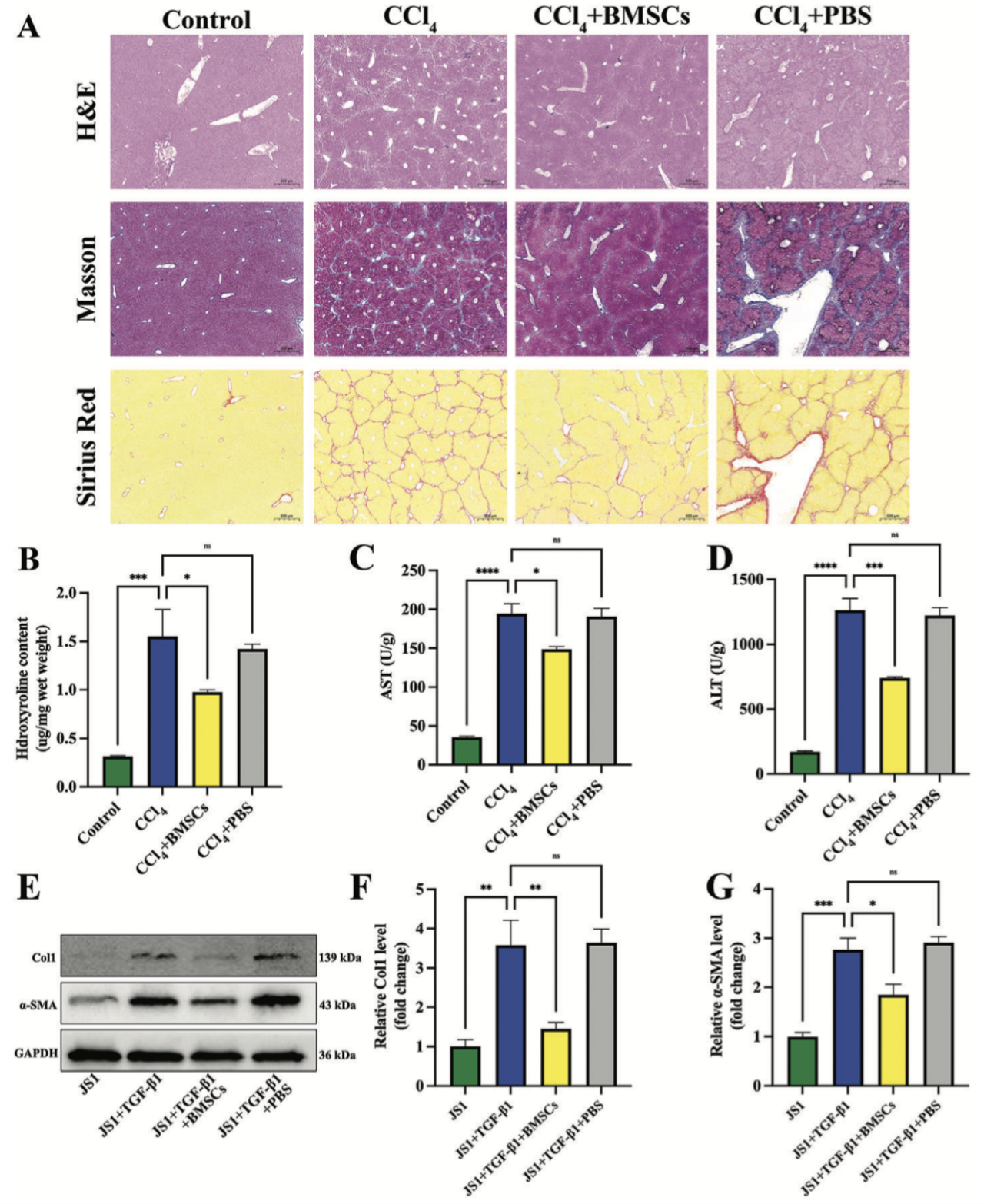 IF＞17.5丨解析骨髓间充质干细胞缓解肝硬化的新机制