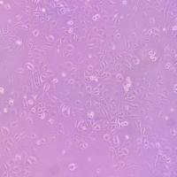 HLE_人肝癌细胞 STR 鉴定