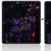 古朵生物— 病理图像分析服务