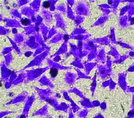 生物细胞培养迁移侵袭MTT转染流式分选诱导整体课题实验服务